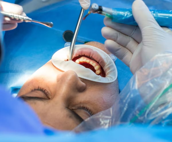 Chirurgie dentara Bucuresti