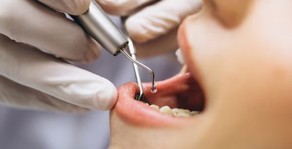 Chirurgie dentara Bucuresti