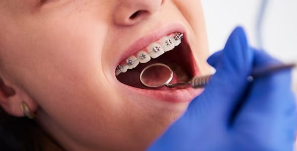 Chirurgie dentara Bucuresti