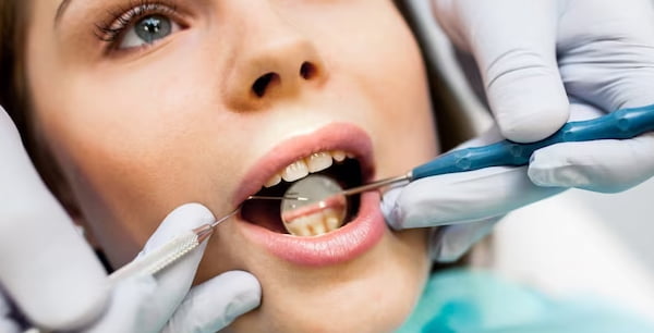 Chirurgie dentara Bucuresti