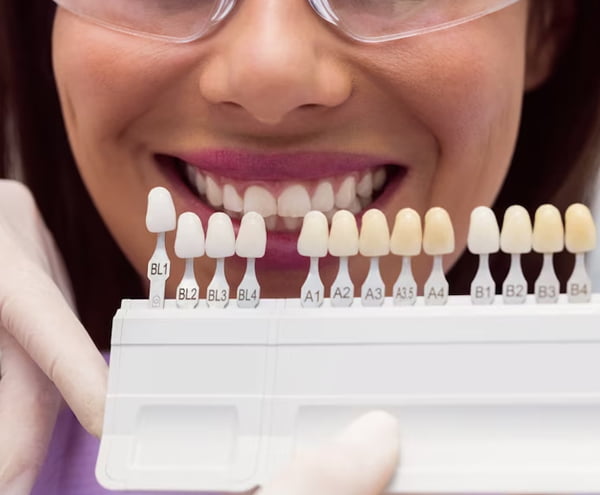 Coroane dentare Bucuresti